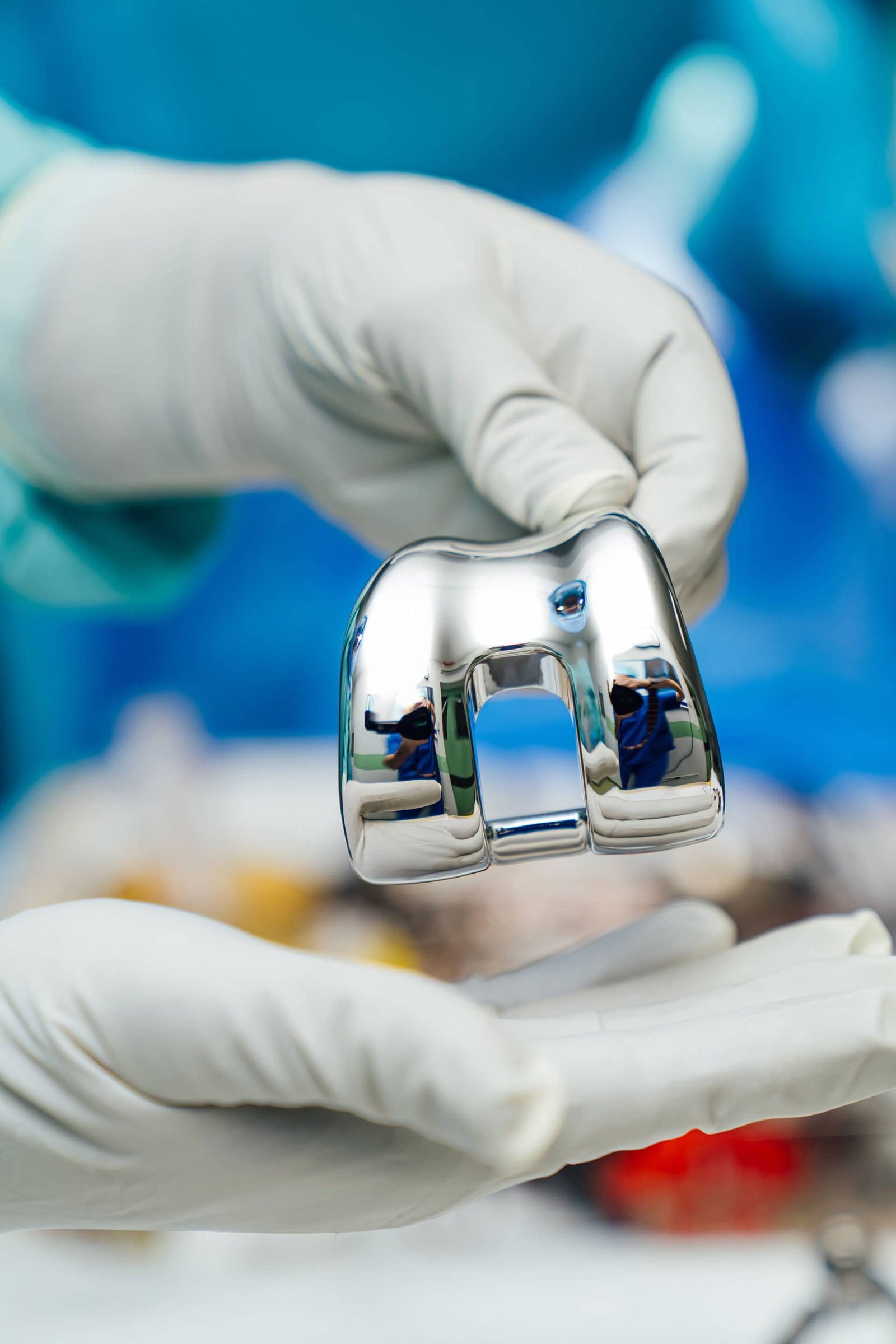 Osteocondroplastias
